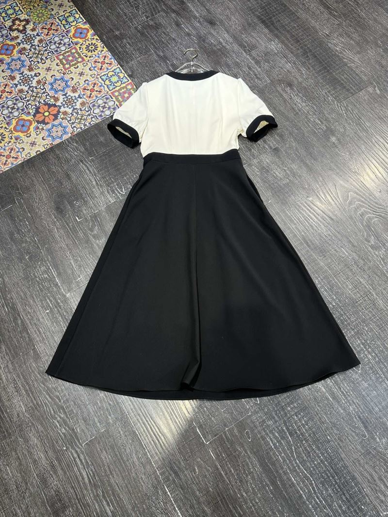 Burberry Dress